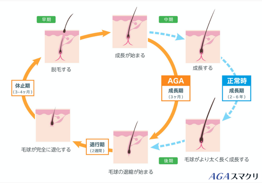 画像に alt 属性が指定されていません。ファイル名: AGAスマクリヘアサイクル-1.png